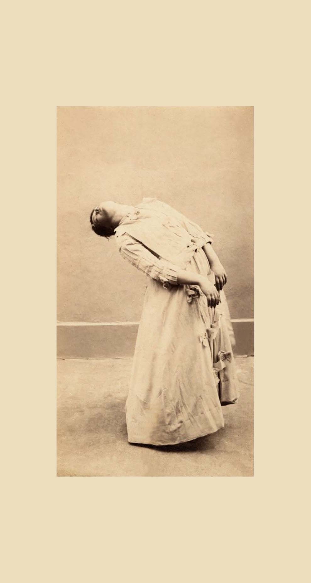 A young psychiatric patient in an ecstatic state, photographed on January 2, 1890 in a French clinic. | Spiegel Geschichte